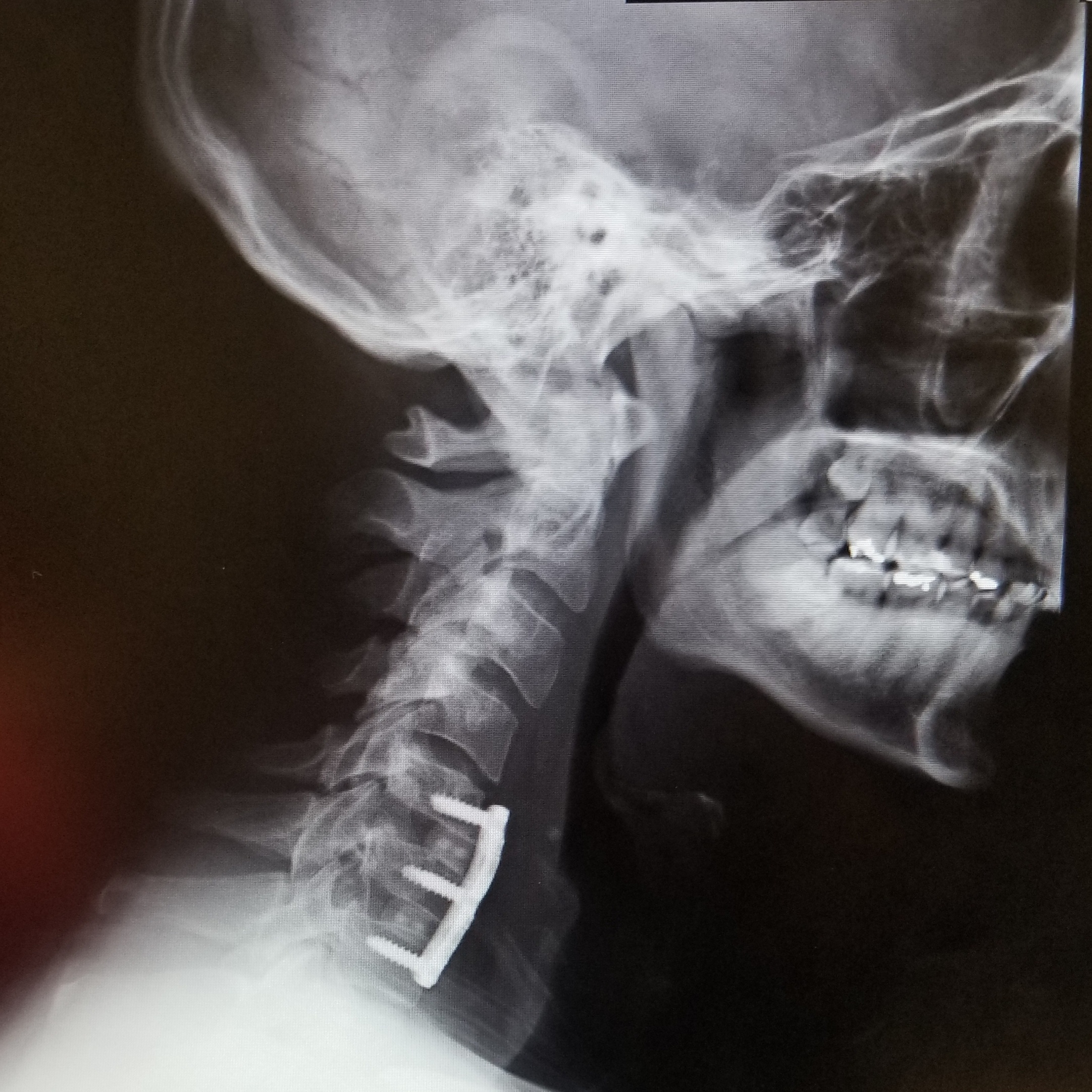 mike.ciufo on One Bite Pizza App